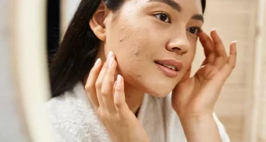 Acne Care
