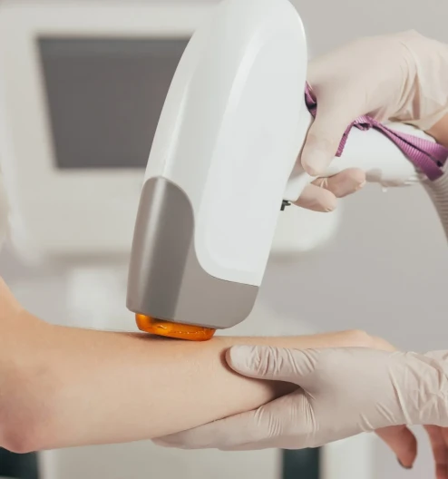 Alexandrite or Diode? Comparing Laser Hair Removal Technologies