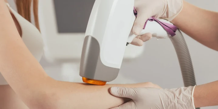 Alexandrite or Diode? Comparing Laser Hair Removal Technologies