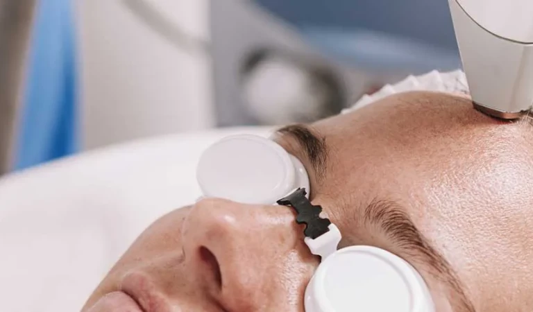 Forehead Laser Hair Removal (Female)