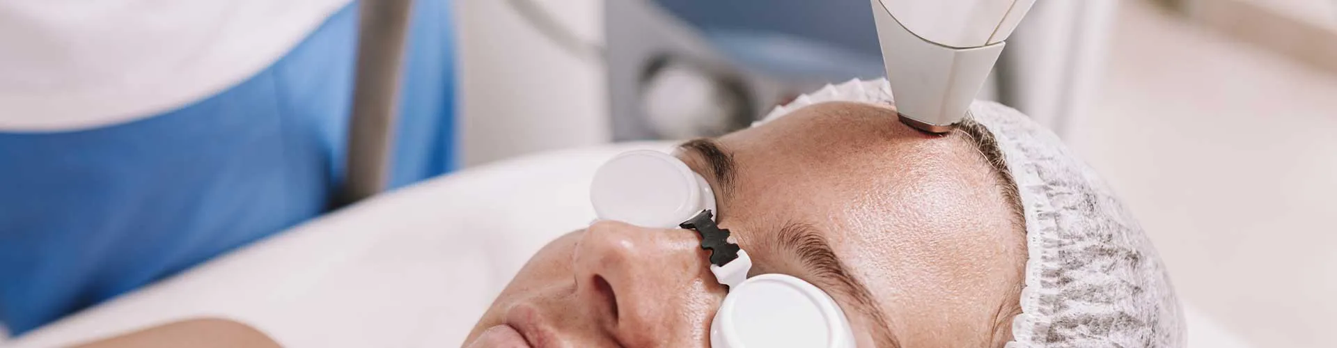 Alın Epilasyon (Kadın)