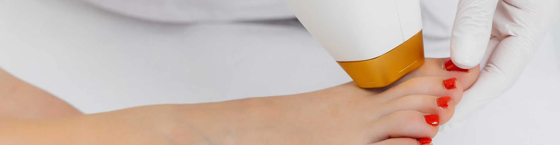 Ayak Üstü Epilasyon (Kadın)