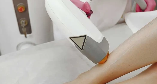 Bacak Epilasyon (Kadın)