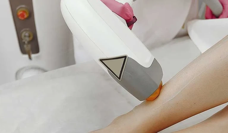 Leg Laser Hair Removal (Female)