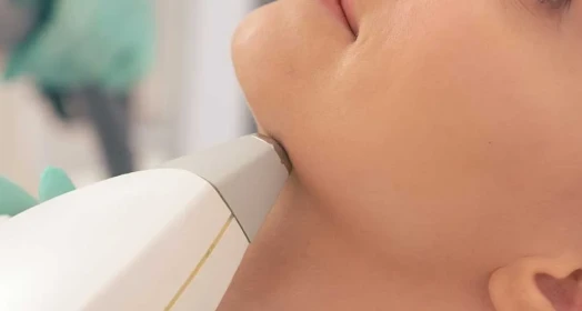 Neck Laser Hair Removal (Female)