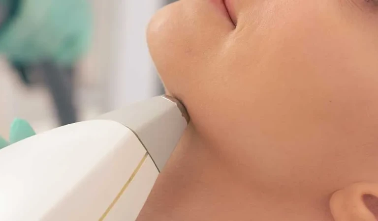 Neck Laser Hair Removal (Female)