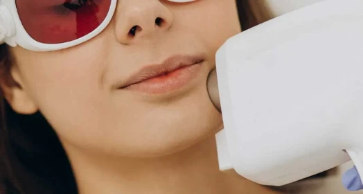 Chin Laser Hair Removal (Female)