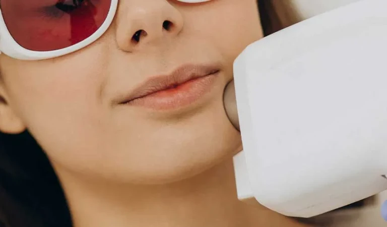 Chin Laser Hair Removal (Female)