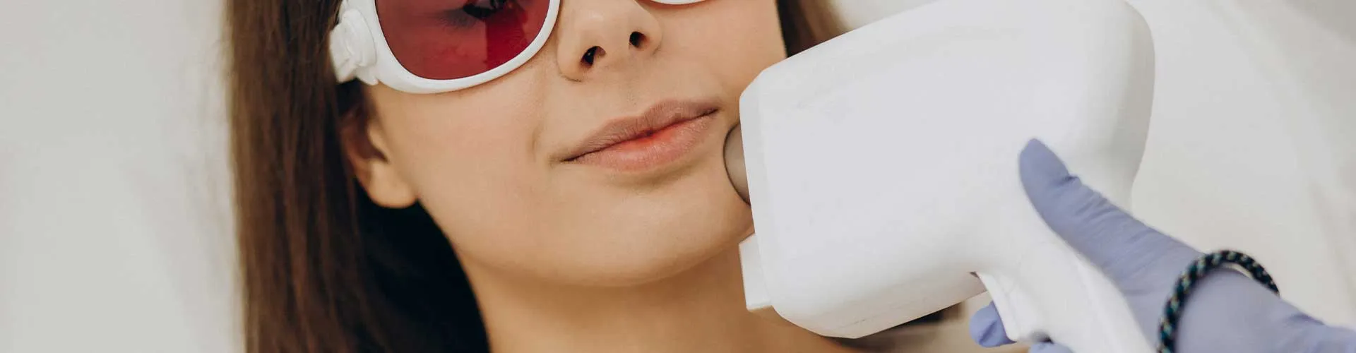 Chin Laser Hair Removal (Female)