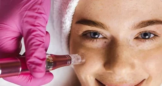 Dermapen For Skin Renewal