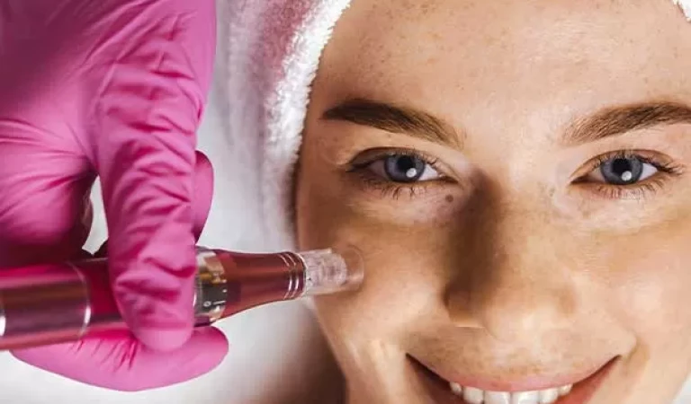 Dermapen For Skin Renewal