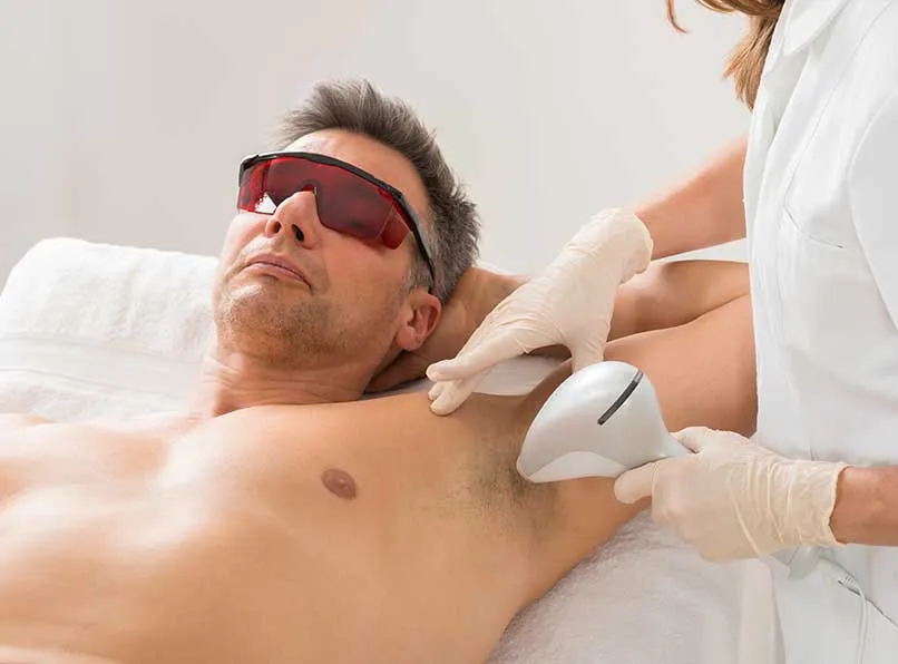 Men’s Hair Removal Guide: Targeted Laser Treatments and Managing Concerns