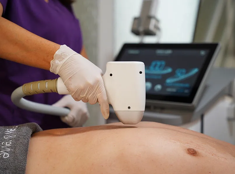 Men’s Laser Hair Removal: A Guide to Lasting Comfort