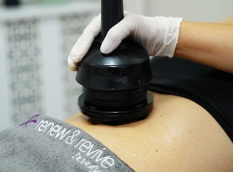 Benefits of G5 Massage: Cellulite Reduction & Body Contouring