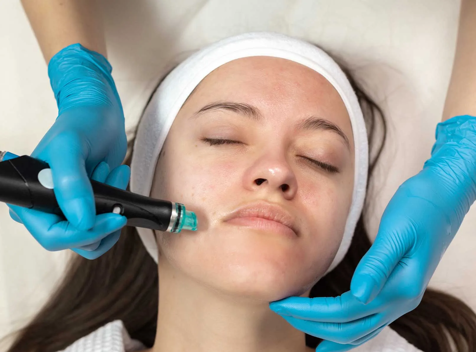 Hydrafacial Cilt Bakımı: Derinlemesine Temizlik ve Yenileme Rehberi