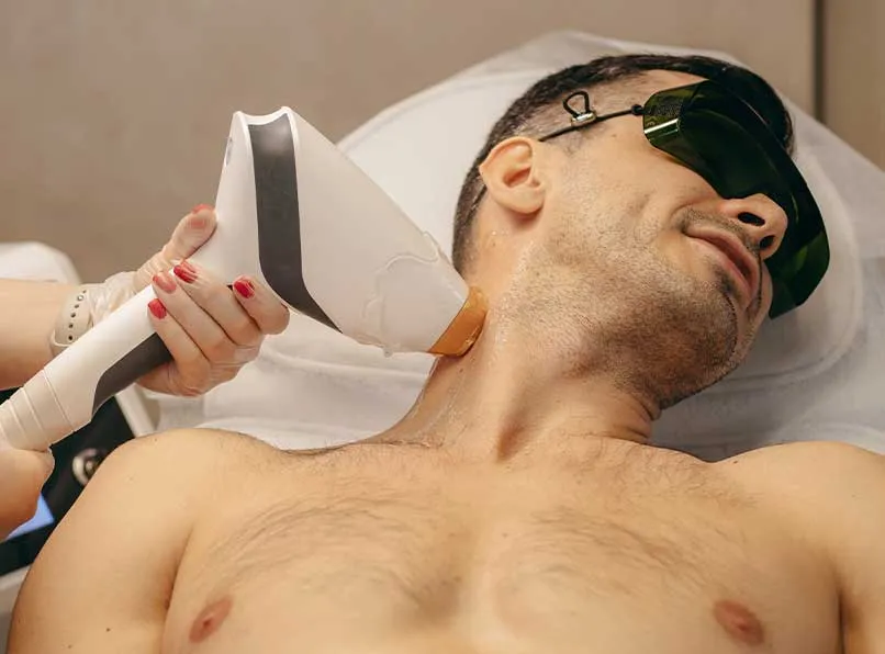 Painless Hair Removal for Men with Smart Diode Ice Laser
