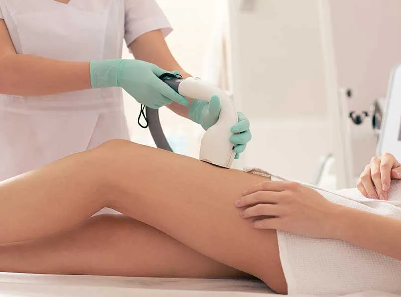 Full Body Laser Hair Removal: Step-by-Step Experience Guide