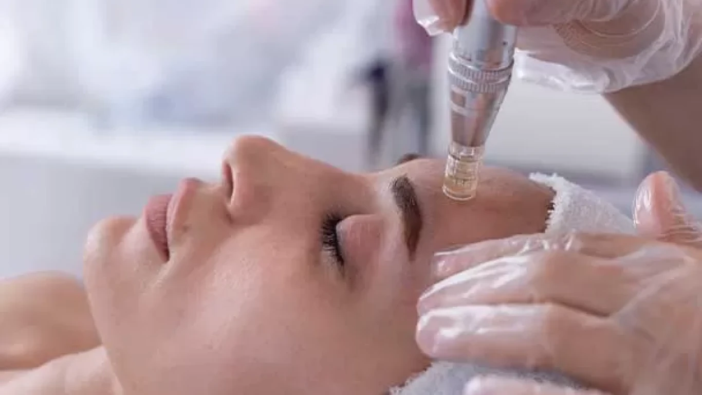 Dermapen
