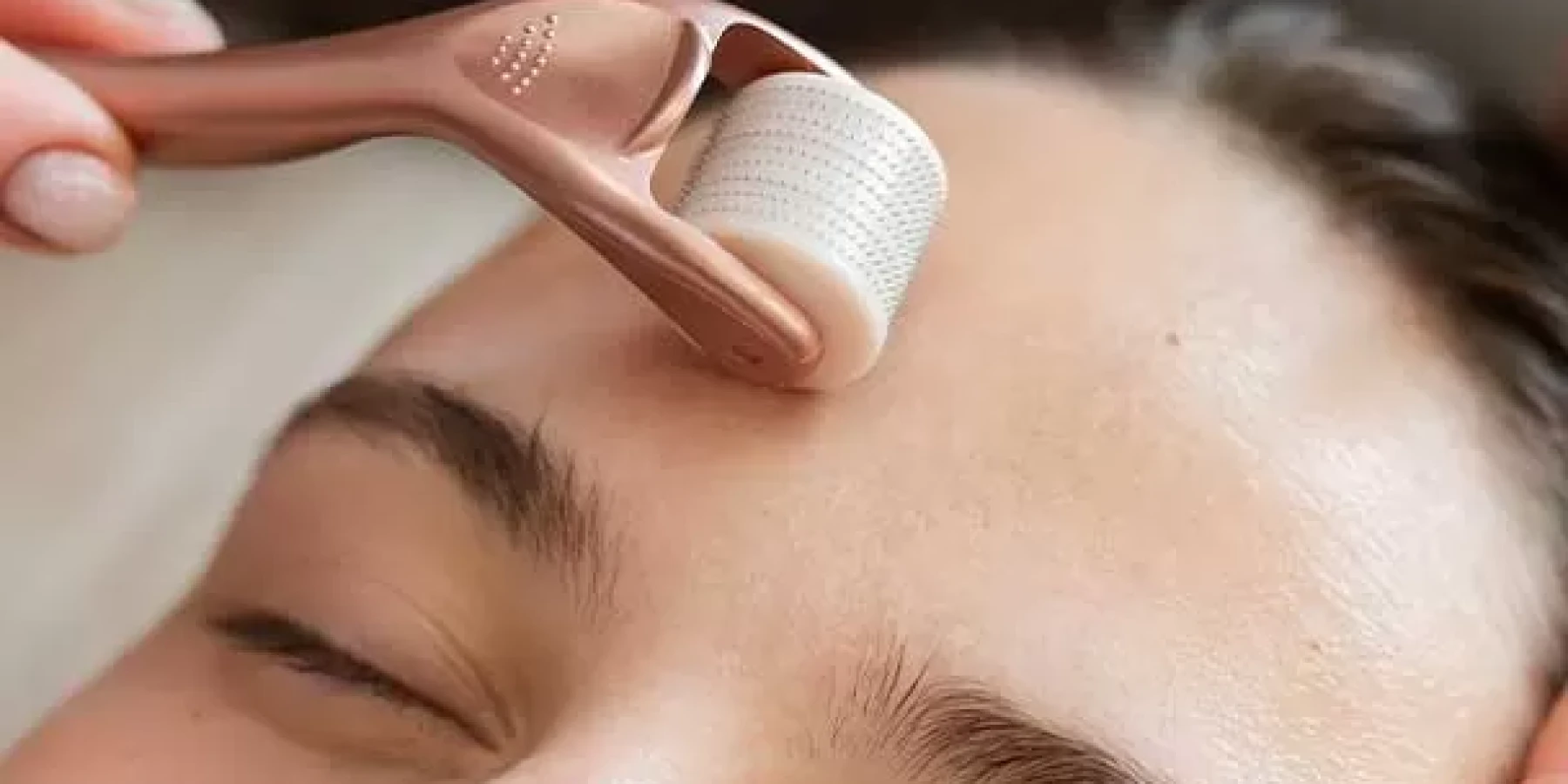 Dermapen & Dermaroller Uygulaması