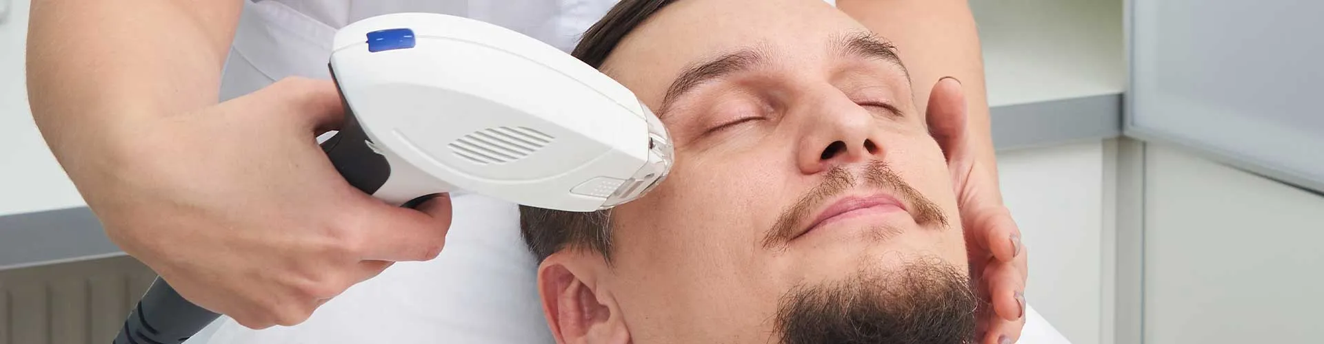 Whiskers Laser Hair Removal (Male)