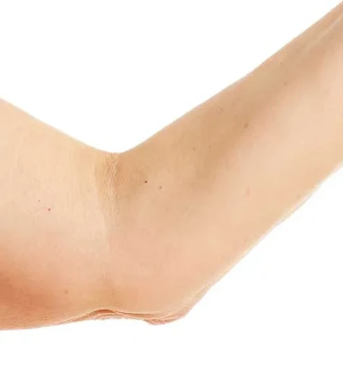 G5 Arm