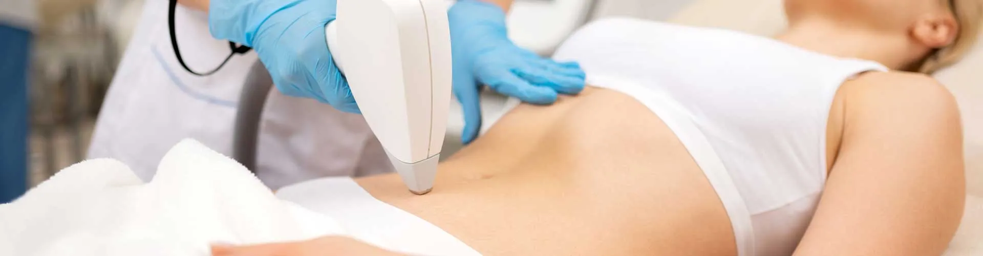 Navel Laser Hair Removal (Female)