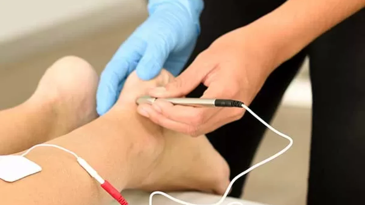 Permanent Solution with Needle Epilation: How Does It Work?