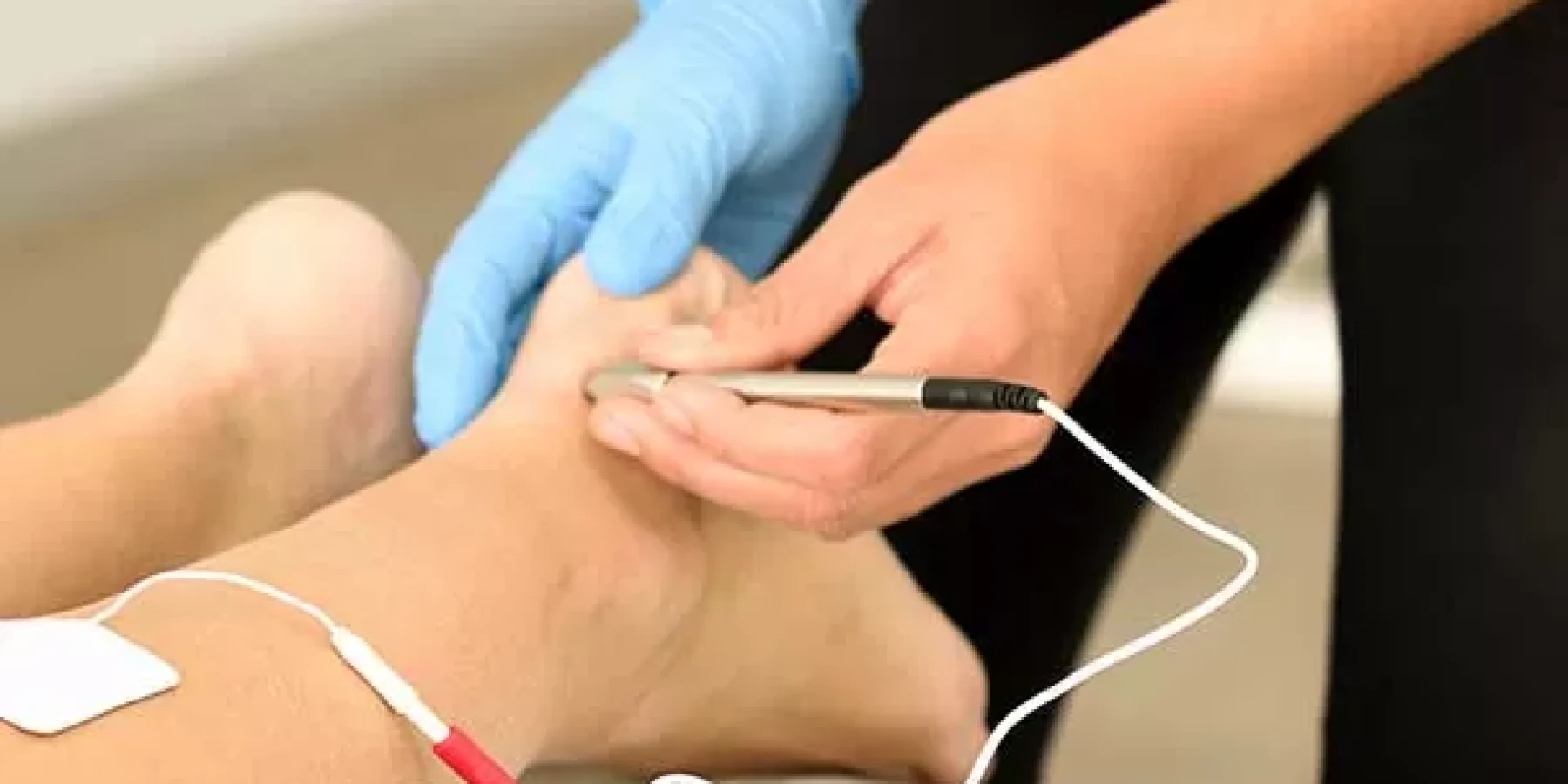 İğneli Epilasyon ile Kalıcı Çözüm: Nasıl Çalışır?