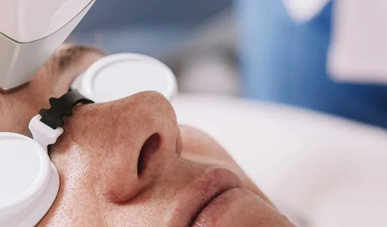 Laser Hair Removal Between Eyebrows (Female)