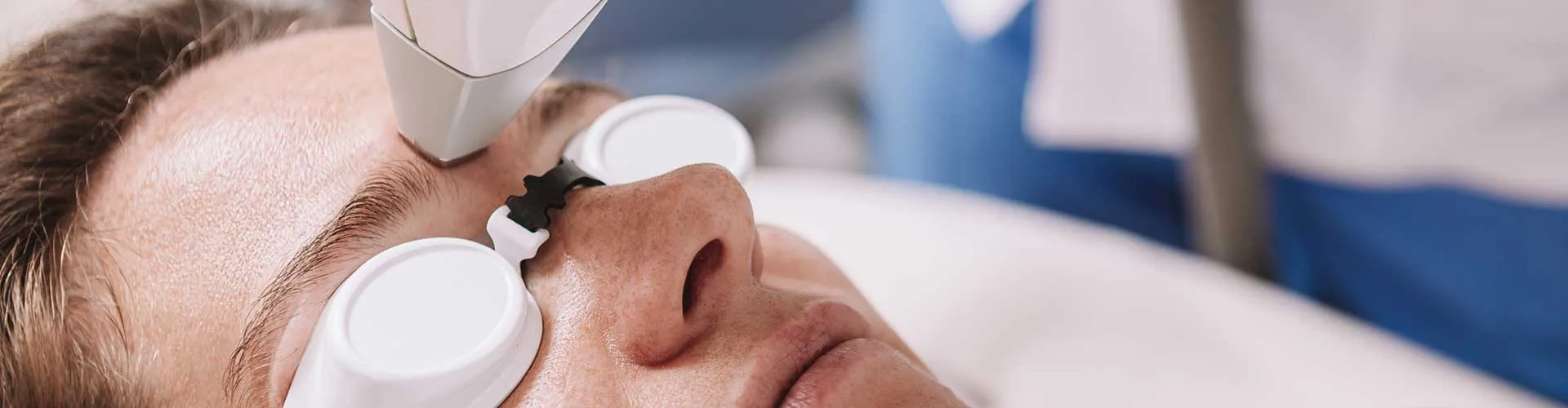 Kaş Arası Epilasyon (Kadın)