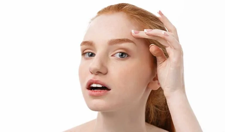 Laser Hair Removal Above the Eyebrow (Female)