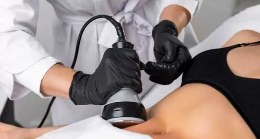 Cavitation
