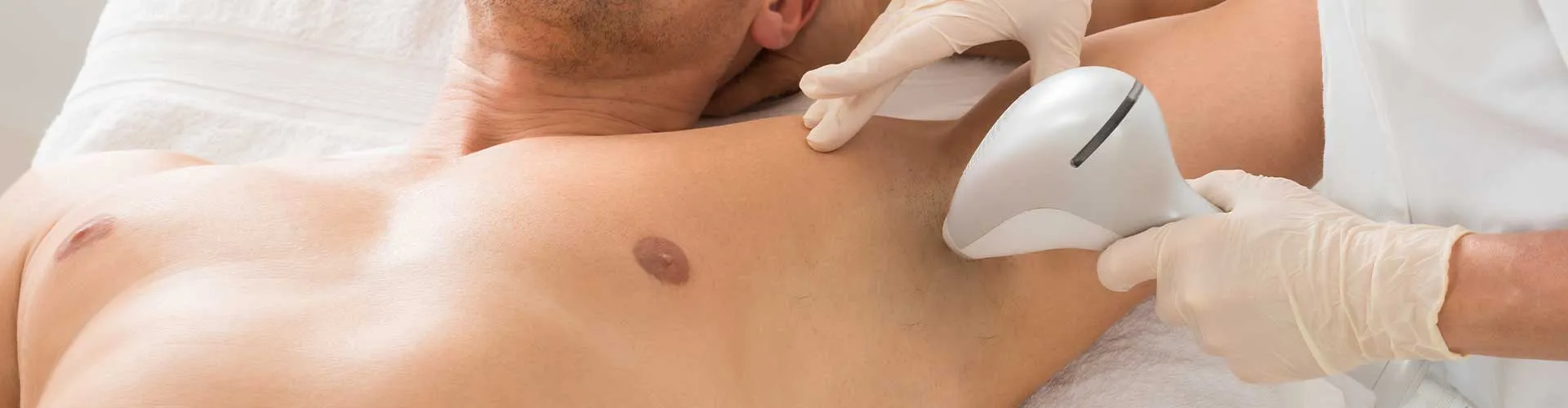 Armpit Laser Hair Removal (Male)