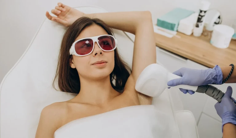 Lazer Epilasyon Kaç Seans Sürer? Bölgeye ve Kıl Tipine Göre Seans Planı