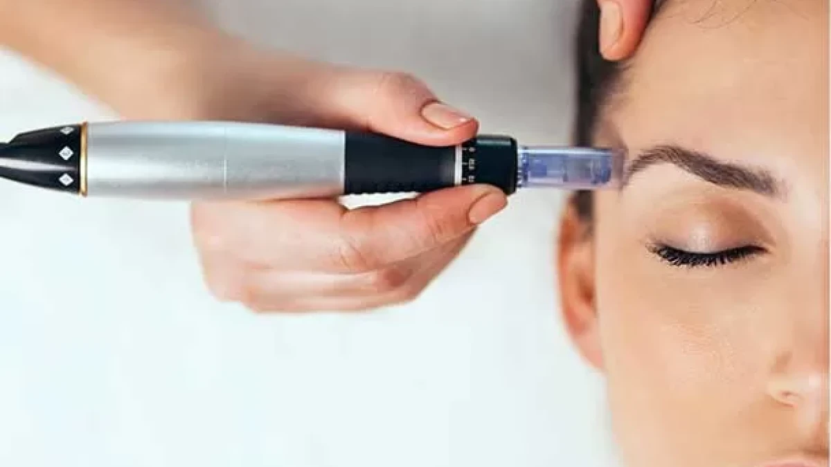 Effects of Dermapen Treatment: Is It Really Effective?