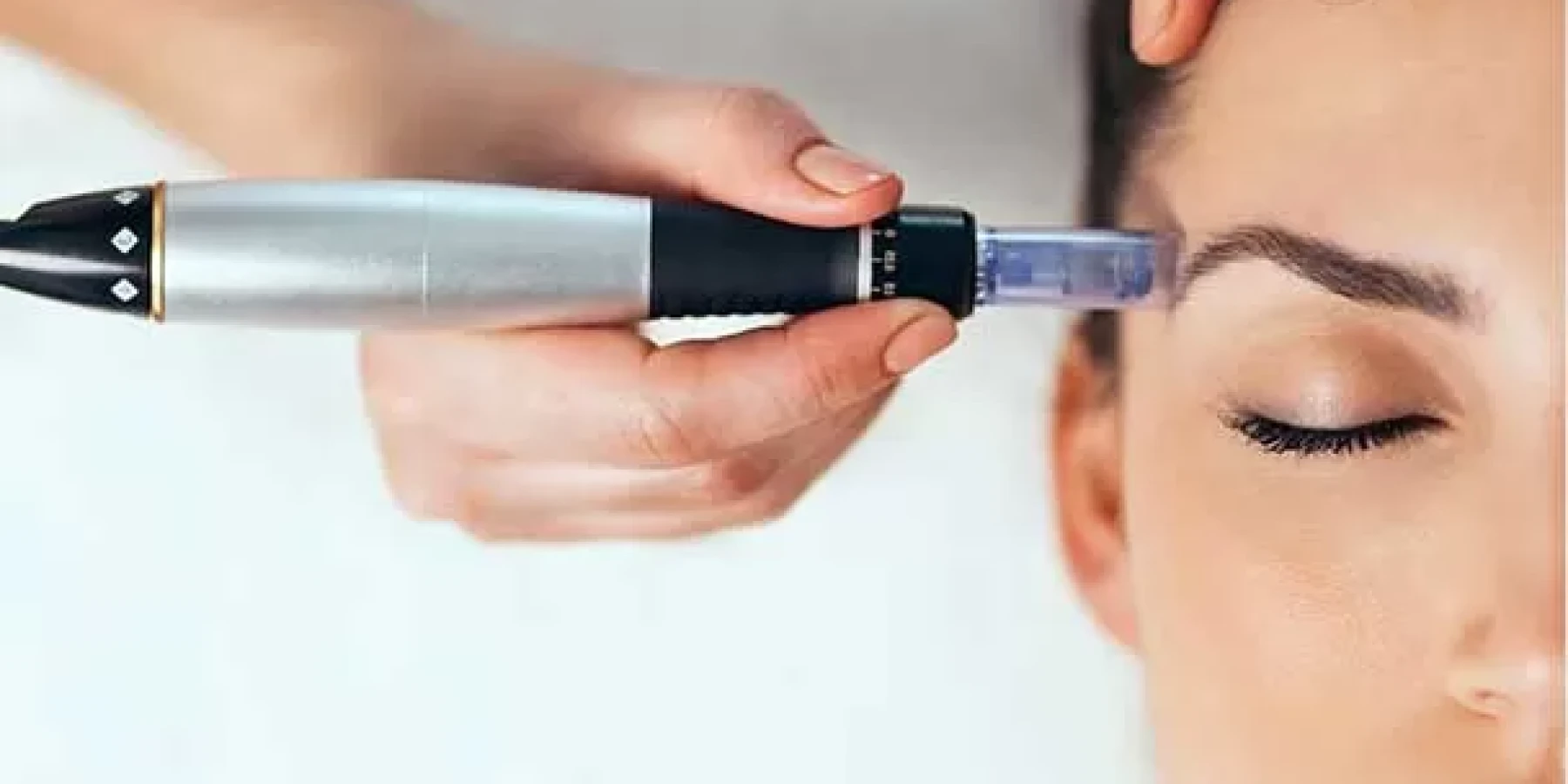 Dermapen Uygulamasının Etkileri: Gerçekten Etkili mi?