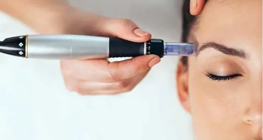 Effects of Dermapen Treatment: Is It Really Effective?