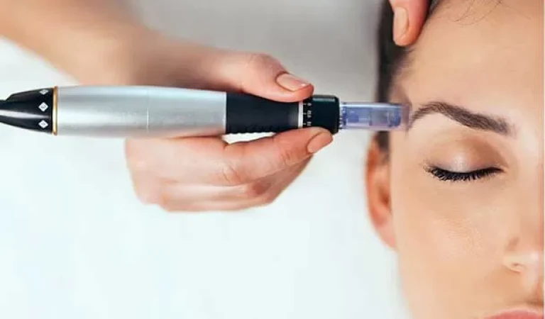 Dermapen Uygulamasının Etkileri: Gerçekten Etkili mi?