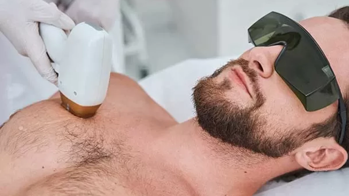 Important Considerations for Male Epilation