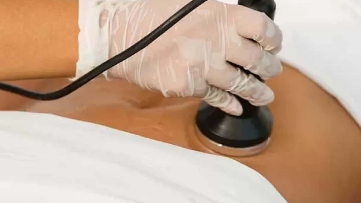 Get Rid of Fat with Cavitation