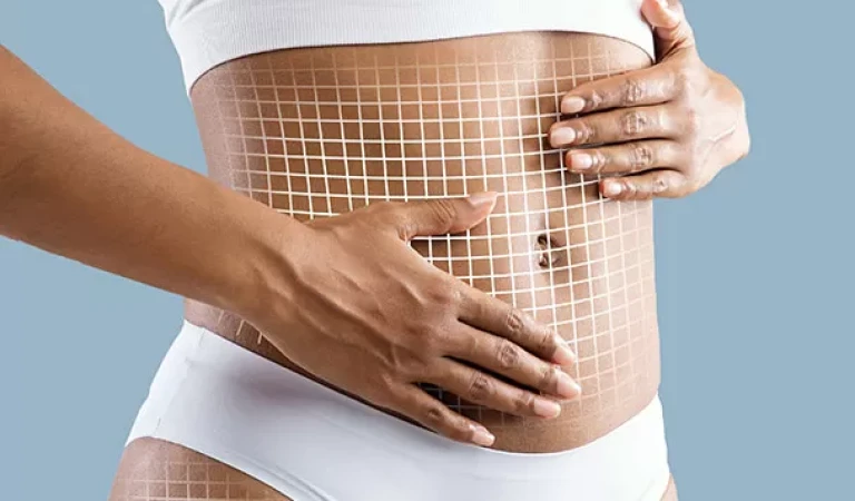 Magic Shape: The Ultimate in Body Sculpting