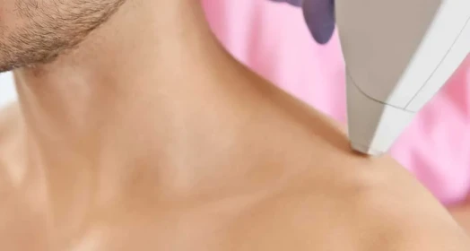 Omuz Epilasyon (Erkek)