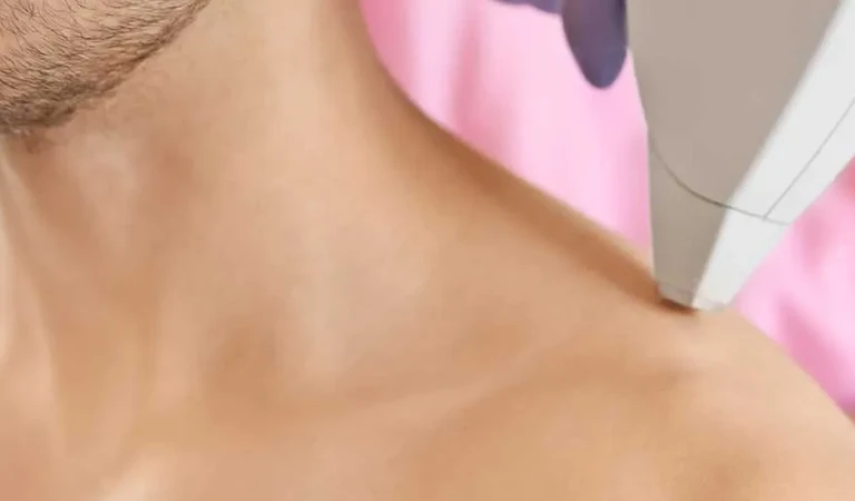 Shoulder Laser Hair Removal (Male)