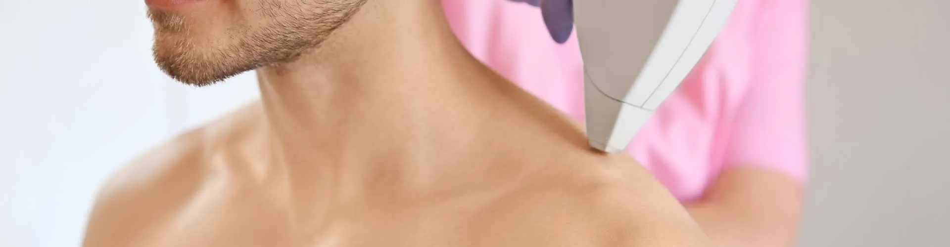 Shoulder Laser Hair Removal (Male)
