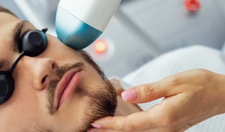 Beard Laser Hair Removal (Male)