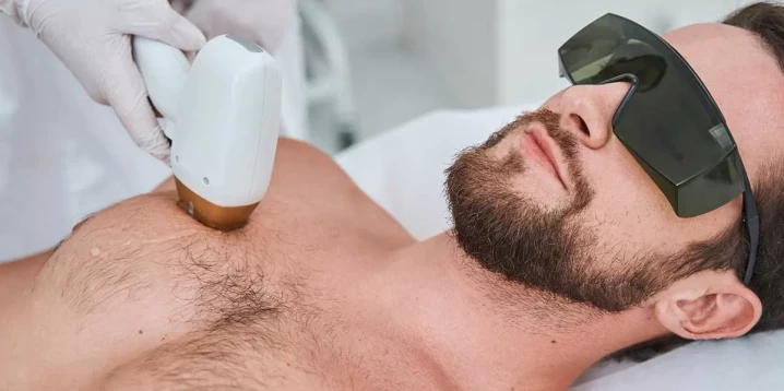 Important Considerations for Male Epilation