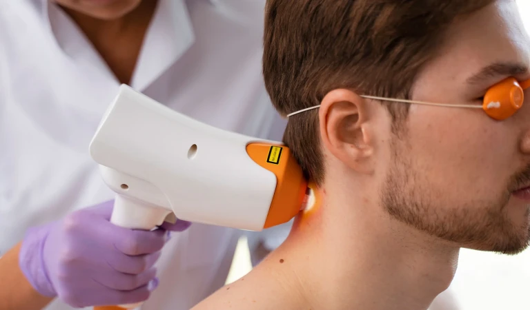 Men’s Laser Hair Removal: Back, Nape, and Beard Guide