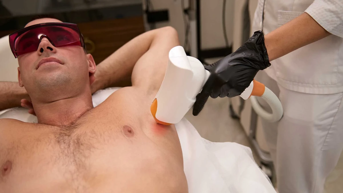 Ingrown Hair in Men: Solutions with Laser Hair Removal