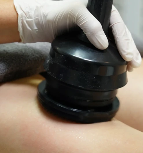 G5 Masajı Nedir? Selülit ve Sıkılaşma Üzerindeki Etkileri