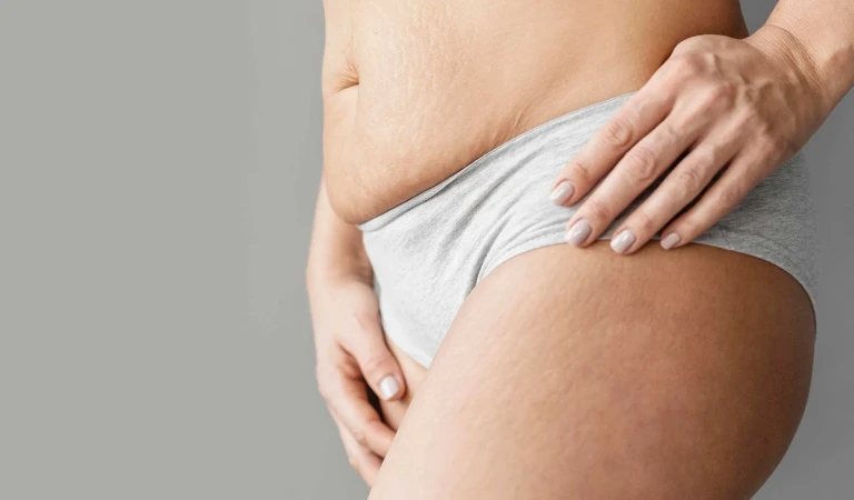 Genital Hair Removal for Women: Safe and Effective Methods